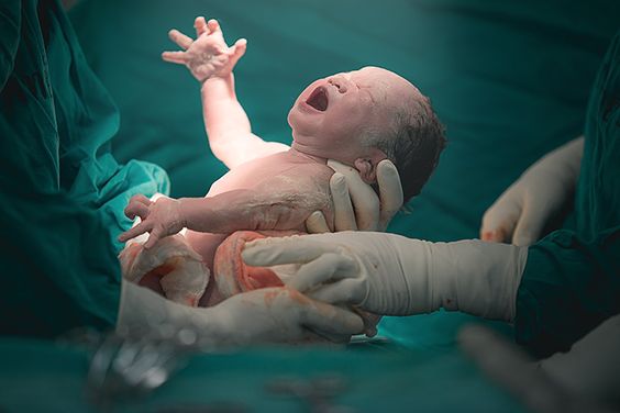 الولادة المبكرة من مخاطر سوء التغذية أثناء الحمل